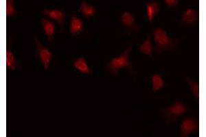 ABIN6268849 staining HuvEc by IF/ICC. (MKL1 antibody  (N-Term))