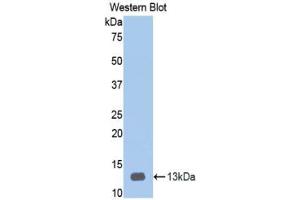 Western blot analysis of recombinant Human HPA. (HPSE antibody  (AA 34-115))