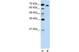 WB Suggested Anti-RORA Antibody Titration:  1.