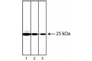 Western blot analysis of Rab27 in human chronic myelogenous leukemia.