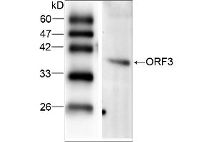 WB analysis of recombinant Hepatitis E virus ORF 3, using HEV ORF3 antibody. (HEV ORF3 antibody  (AA 34-123))