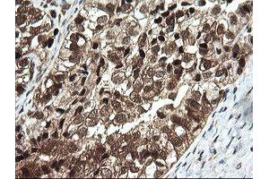 Image no. 1 for anti-OTU Domain, Ubiquitin Aldehyde Binding 1 (OTUB1) antibody (ABIN1499933) (OTUB1 antibody)