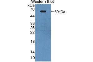 Detection of Recombinant EPHA4, Human using Polyclonal Antibody to Ephrin Type A Receptor 4 (EPHA4) (EPH Receptor A4 antibody  (AA 621-882))