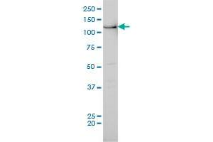 BUB1 antibody  (AA 1-130)