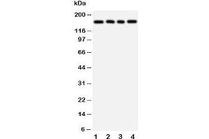 Western blot testing of TNR antibody and Lane 1:  rat brain;  2: human U87;  3: (h) HeLa;  4: (h) MCF-7 cell lysate