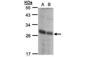 WB Image Sample(30 ug whole cell lysate) A:293T B:A431, 12% SDS PAGE antibody diluted at 1:1000 (NQO2 antibody  (Center))