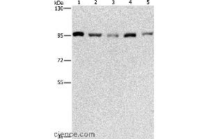 Western blot analysis of HepG2, K562, Jurkat, 231 and hela cell, using MCM5 Polyclonal Antibody at dilution of 1:475 (MCM5 antibody)