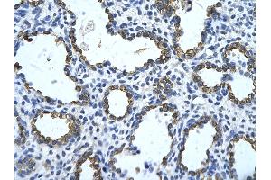 Rabbit Anti-GNAS Antibody       Paraffin Embedded Tissue:  Human alveolar cell   Cellular Data:  Epithelial cells of renal tubule  Antibody Concentration:   4. (GNAS antibody  (N-Term))
