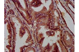Immunohistochemistry (IHC) image for anti-Protein Phosphatase 2A Activator, Regulatory Subunit 4 (PPP2R4) (AA 1-250) antibody (ABIN7169262)
