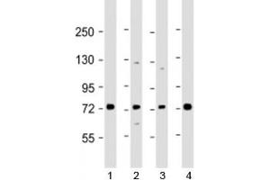 Western blot testing of human 1) Raji, 2) A549, 3) HL-60 and 4) K562 cell lysate with SKI antibody at 1:2000. (SKI antibody  (AA 21-54))