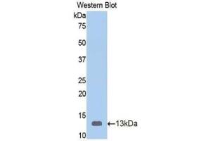 Western blot analysis of the recombinant protein. (Vitamin D-Binding Protein antibody  (AA 395-475))