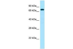 Western Blotting (WB) image for anti-zeta-Chain (TCR) Associated Protein Kinase 70kDa (ZAP70) (Middle Region) antibody (ABIN2788711) (ZAP70 antibody  (Middle Region))