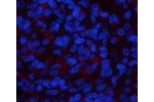 Immunofluorescence analysis of Rat spleen tissue using NBR1 Monoclonal Antibody at dilution of 1:200. (NBR1 antibody)
