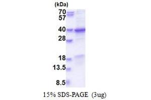 Chromosome 7 Open Reading Frame 20 (C7orf20) (AA 1-327) protein (His tag)