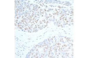 Immunohistochemistry (IHC) image for anti-Suppressor of Ty 6 Homolog (SUPT6H) (AA 425-475) antibody (ABIN7453850) (Spt6 antibody  (AA 425-475))