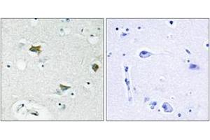 Immunohistochemistry analysis of paraffin-embedded human brain tissue, using BAD (Ab-91/128) Antibody.