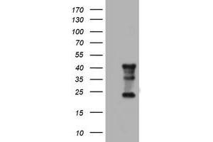 Image no. 8 for anti-Transmembrane Protein 173 (TMEM173) antibody (ABIN1501428)