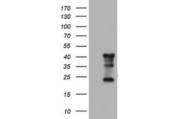 STING/TMEM173 antibody