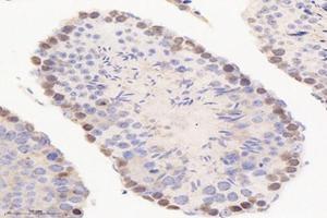 Immunohistochemistry analysis of paraffin-embedded mouse testis using,PME-1 (ABIN7075286) at dilution of 1: 2000 (PPME1 antibody)