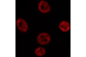 ABIN6269269 staining Hep G2 cells by IF/ICC.
