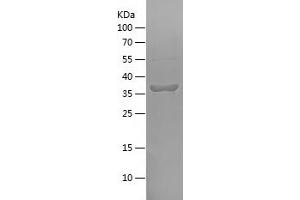 Western Blotting (WB) image for Low Density Lipoprotein Receptor (LDLR) (AA 455-607) protein (His-IF2DI Tag) (ABIN7282249) (LDLR Protein (AA 455-607) (His-IF2DI Tag))