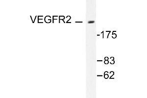 Image no. 1 for anti-VEGF Receptor 2 (VEGFR2) antibody (ABIN271861) (VEGFR2/CD309 antibody)