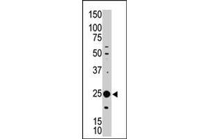 The MAGEH1 polyclonal antibody  is used in Western blot to detect MAGEH1 in Jurkat cell lysate. (MAGEH1 antibody  (C-Term))