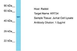 Host: Rabbit Target Name: KRT34 Sample Tissue: Human Jurkat Whole Cell Antibody Dilution: 1ug/ml (Keratin 34 antibody  (C-Term))