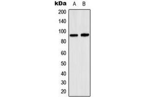 Western blot analysis of SP1 expression in K562 (A), A431 (B) whole cell lysates. (SP1 antibody  (Center))