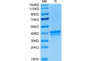 Human BCMA/TNFRSF17 on Tris-Bis PAGE under reduced condition. (BCMA Protein (AA 1-54) (Fc Tag))