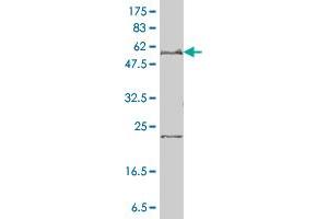 SLC27A4 monoclonal antibody (M01), clone 1F4-1B10 Western Blot analysis of SLC27A4 expression in HeLa . (SLC27A4 antibody  (AA 1-237))
