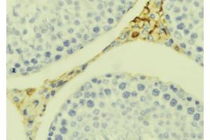 ABIN6273392 at 1/100 staining Mouse testis tissue by IHC-P. (CCL20 antibody  (Internal Region))