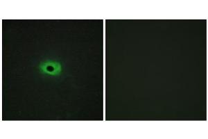 Immunofluorescence analysis of HeLa cells, using Syndecan4 (epitope around residue 179) antibody. (SDC4 antibody  (Ser179))