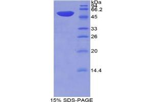 SDS-PAGE analysis of Mouse Thrombospondin 2 Protein.