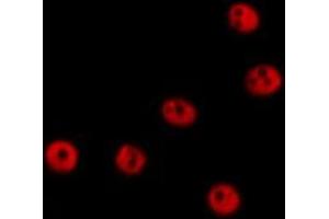 ABIN6278345 staining  Hela cells by IF/ICC. (RECQL2 antibody  (Internal Region))