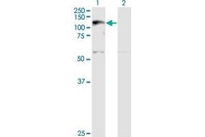 Western Blot analysis of XPO5 expression in transfected 293T cell line by XPO5 monoclonal antibody (M01A), clone 2C5-1B3. (XPO5 antibody  (AA 1-280))
