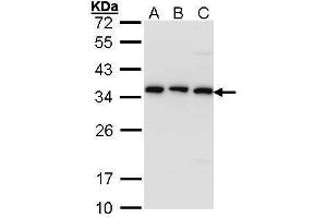 WB Image Sample (30 ug of whole cell lysate) A: A431 , B: H1299 C: Hela 12% SDS PAGE antibody diluted at 1:1000 (TBCB antibody)