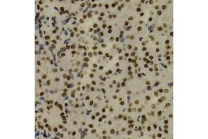 Immunohistochemistry of paraffin-embedded mouse kidney using NFKB2 antibody at dilution of 1:200 (400x lens). (NFKB2 antibody)