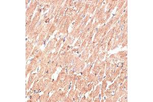 Immunohistochemistry of paraffin-embedded rat heart using KTN1 antibody. (KTN1 antibody  (AA 1-100))