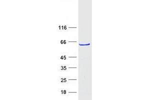 Validation with Western Blot