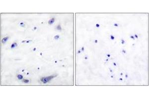 Immunohistochemistry analysis of paraffin-embedded human brain tissue, using Tyrosine Hydroxylase (Ab-31) Antibody. (Tyrosine Hydroxylase antibody  (AA 1-50))