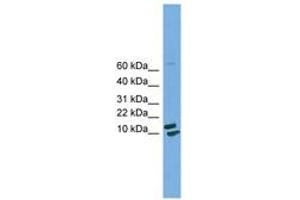 Image no. 1 for anti-Peptidylprolyl Isomerase H (Cyclophilin H) (PPIH) (AA 71-120) antibody (ABIN6744943) (PPIH antibody  (AA 71-120))