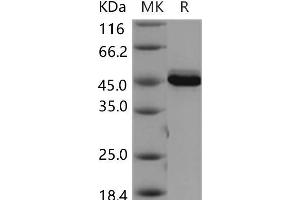 Western Blotting (WB) image for V-Akt Murine Thymoma Viral Oncogene Homolog 3 (Protein Kinase B, Gamma) (AKT3) (Active) protein (ABIN7319999) (AKT3 Protein)
