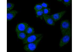 HepG2 cells were fixed in paraformaldehyde, permeabilized with 0. (STAT6 antibody)