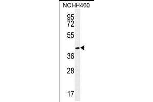 Western blot analysis in NCI-H460 cell line lysates (35ug/lane). (GGH antibody  (C-Term))