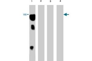 Western blot analysis of extract from red sea bream (lane 1) , carp (lane 2) , mummichog (lane 3) and medaka (lane 4) , using Vitellogenin monoclonal antibody, clone 5A4  . (Vitellogenin 2 antibody)