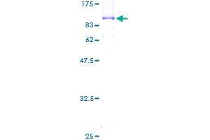 ORC2 Protein (AA 1-577) (GST tag)