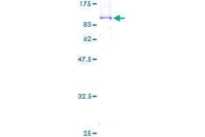 SDS-PAGE (SDS) image for Origin Recognition Complex Subunit 2 (ORC2) (AA 1-577) protein (GST tag) (ABIN1313650) (ORC2 Protein (AA 1-577) (GST tag))