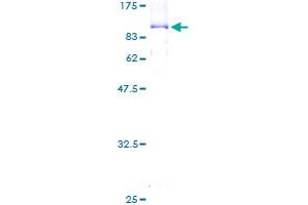 ORC2 Protein (AA 1-577) (GST tag)