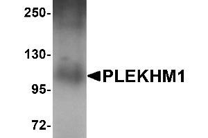 Western Blotting (WB) image for anti-Pleckstrin Homology Domain Containing, Family M (With RUN Domain) Member 1 (PLEKHM1) (N-Term) antibody (ABIN1031519) (PLEKHM1 antibody  (N-Term))